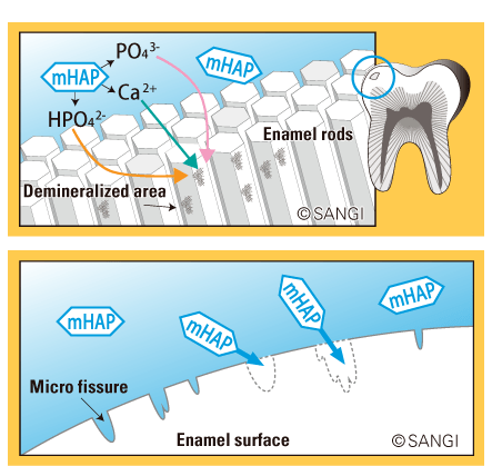 illustrations showing nano mhap fixing microfissures on enamel surface