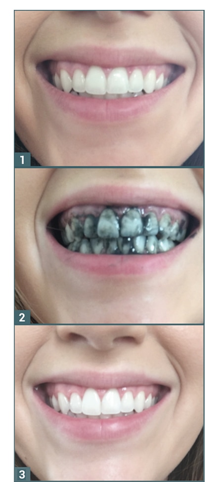 Oral | CURAPROX Black is White