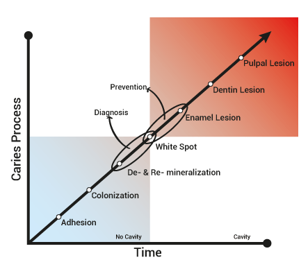 graph showing when caries can be remineralized