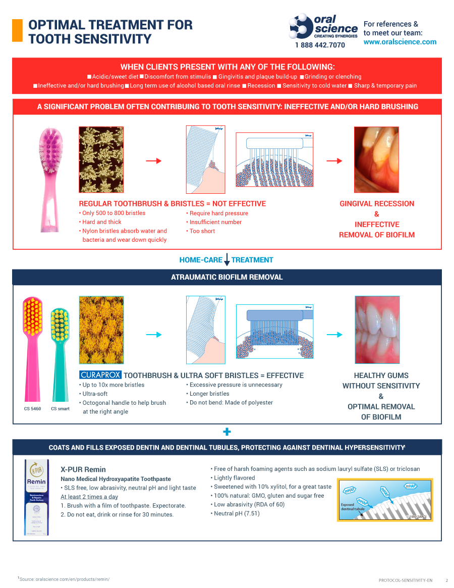 graph showing possible causes and effects of tooth sensitivity