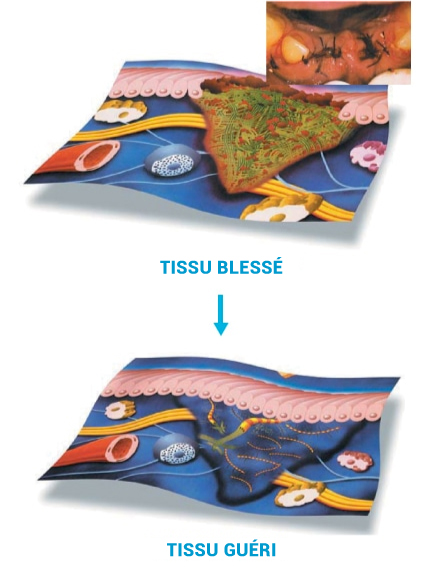 illustation of injured and healed tissue